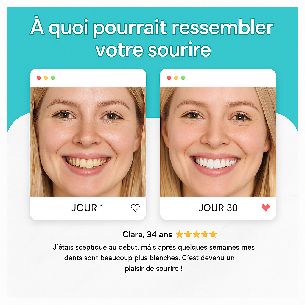 Brosse à dents électrique en U – Blanc | LumiBrush™