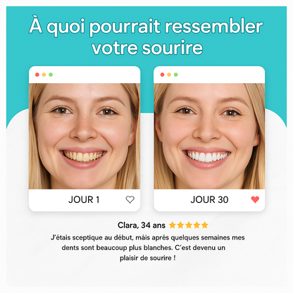 Brosse à dents électrique en U – Noir | LumiBrush™